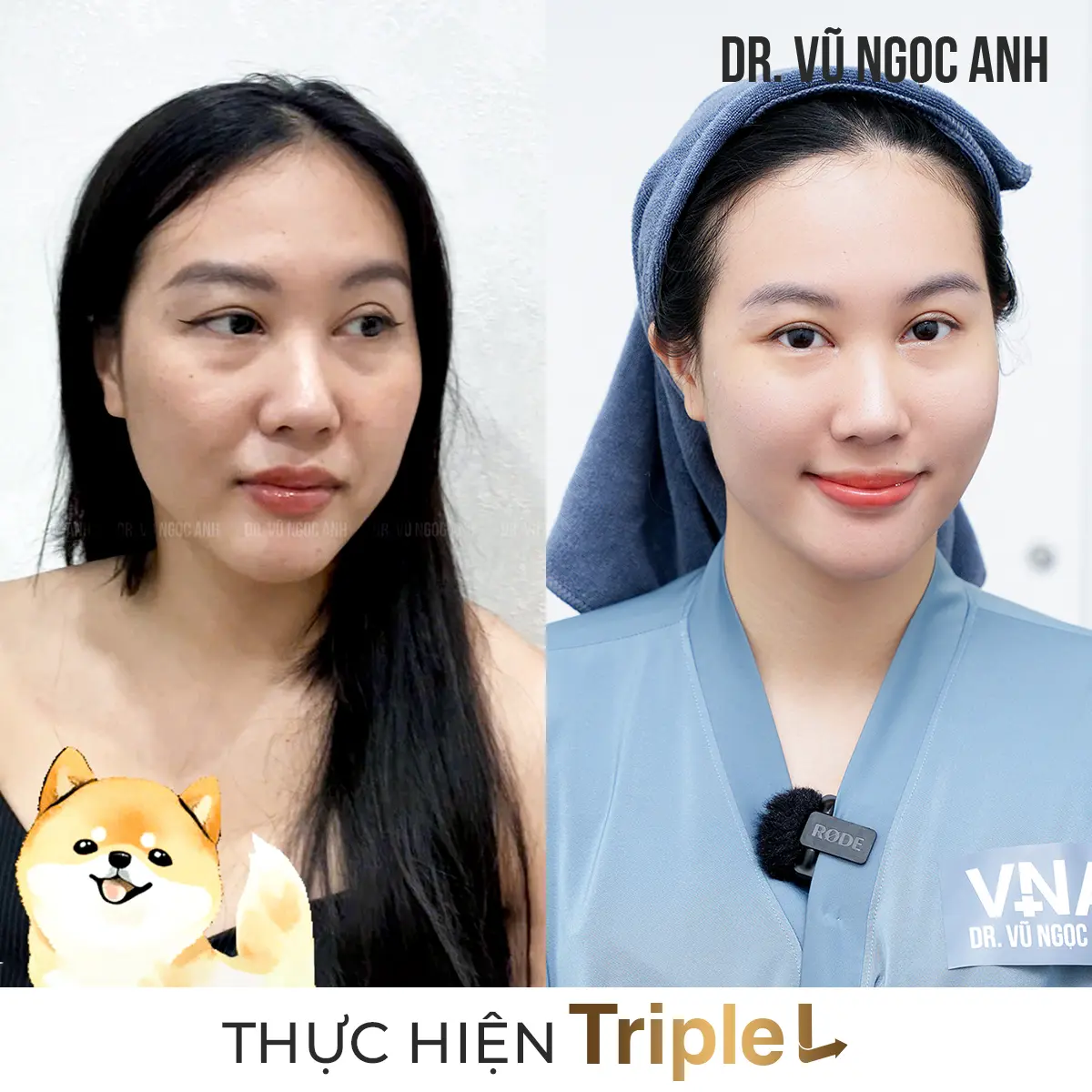 khách hàng sau khi thực hiện liệu trình Căng bóng da Triple L 2