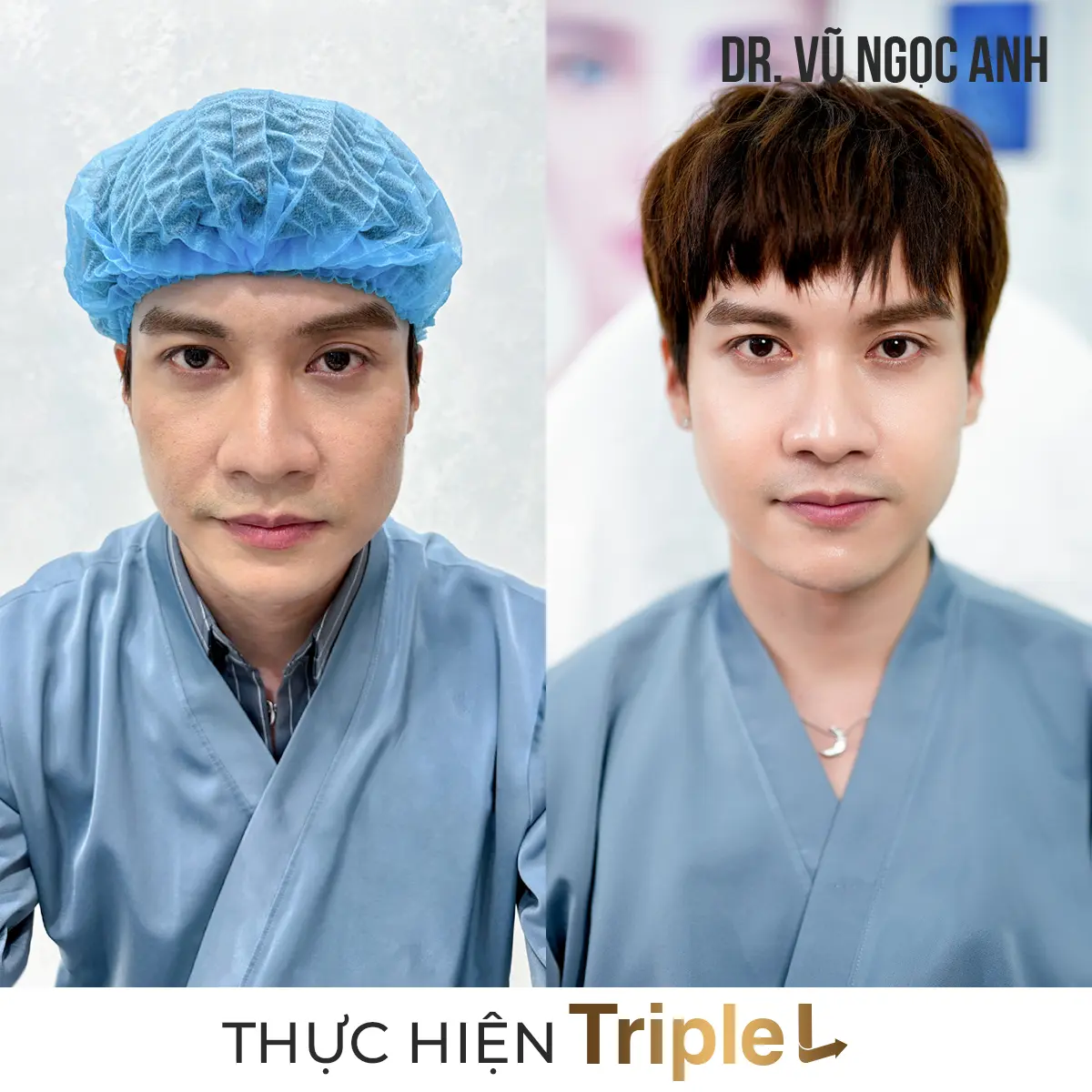 khách hàng sau khi thực hiện liệu trình Căng bóng da Triple L 3