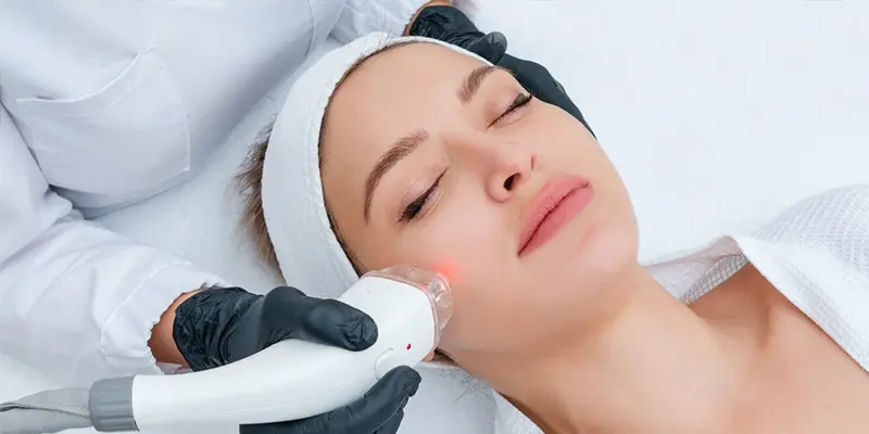 Nâng cơ mặt bằng công nghệ Laser