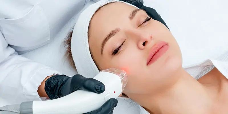 Cách điều trị nám mảng và bảng giá dịch vụ mới nhất hiện nay 4 Điều trị nám mảng bằng công nghệ Laser