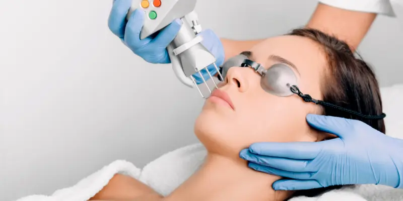 Các phương pháp điều trị nám chân sâu mới nhất hiện nay 3 Điều trị nám chân sâu bằng Công nghệ Laser