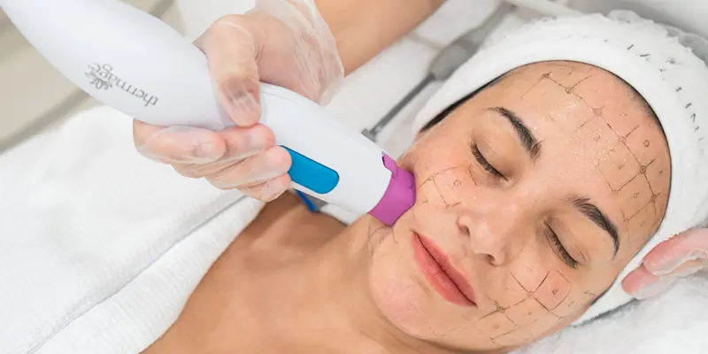 Top 5 Phương Pháp Nâng Cơ Mặt Hiệu Quả Nhất Hiện Nay 3 Nâng cơ mặt bằng công nghệ Thermage