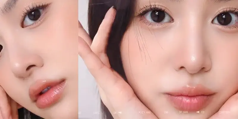 Trẻ hoá da mặt ở đâu tốt? Bảng giá mới nhất 2025 1 Trẻ hoá da mặt ở đâu tốt