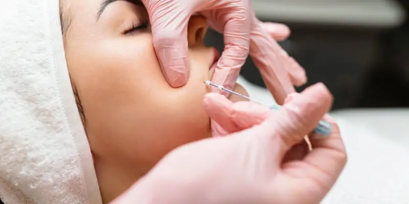 Top 5 Phương Pháp Nâng Cơ Mặt Hiệu Quả Nhất Hiện Nay 4 Cấy chỉ collagen