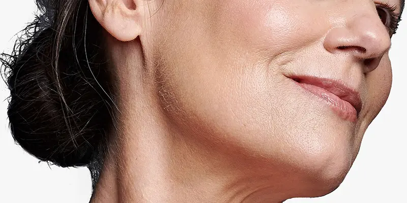 Trẻ hoá da mặt ở đâu tốt? Bảng giá mới nhất 2025 2 Trẻ hóa da mặt