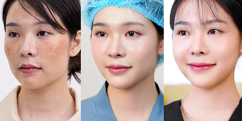 Điều Trị Nám Da Mặt Và Tàn Nhang Ở Đâu Uy Tín? Bí Quyết Lựa Chọn Đúng 4 Khách hàng điều trị nám của Br. Vũ Ngọc Anh