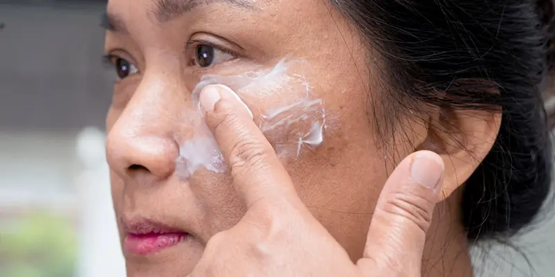 Cách Trị Nám Tàn Nhang Lâu Năm Hiệu Quả: Giải Pháp Dứt Điểm Và Hồi Sinh Làn Da 3 Kem trộn hoặc thuốc bôi không rõ nguồn gốc