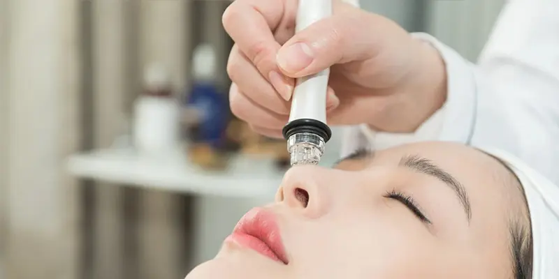Nguyên nhân bọng mắt dưới là gì? Cách xóa bọng mắt nhanh, tự nhiên và an toàn 5 Xóa bọng mắt bằng công nghệ thẩm mỹ