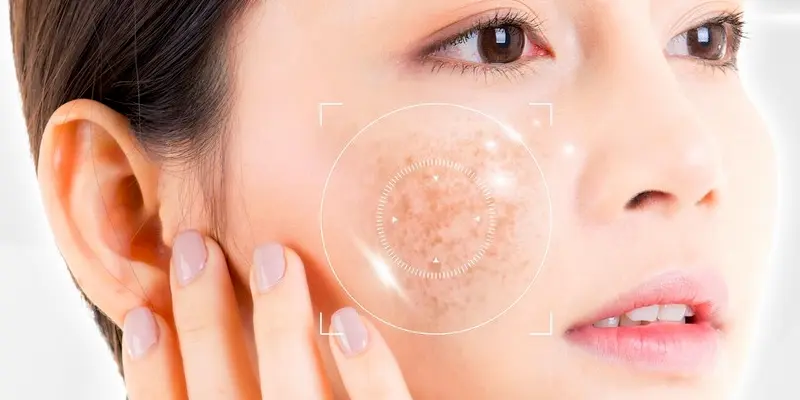 Nám Chân Sâu Là Gì? Nguyên Nhân Và Các Phương Pháp Điều Trị Hiệu Quả 2 Nám chân sâu