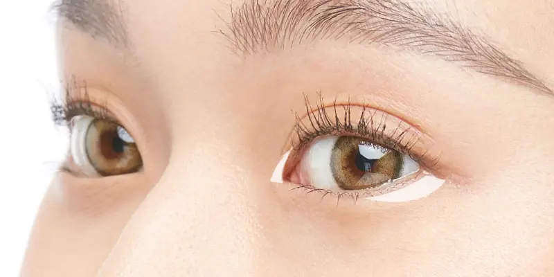 Cắt Mí Mở Góc Mắt Ở Đâu Đẹp?