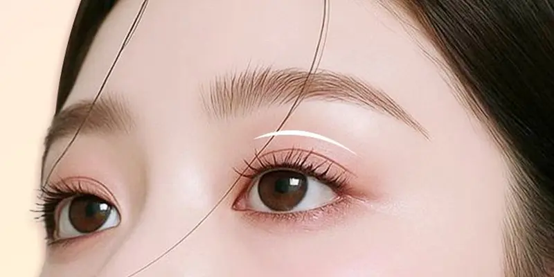 Khi Nào Nên Nâng Cơ Mí Mắt?