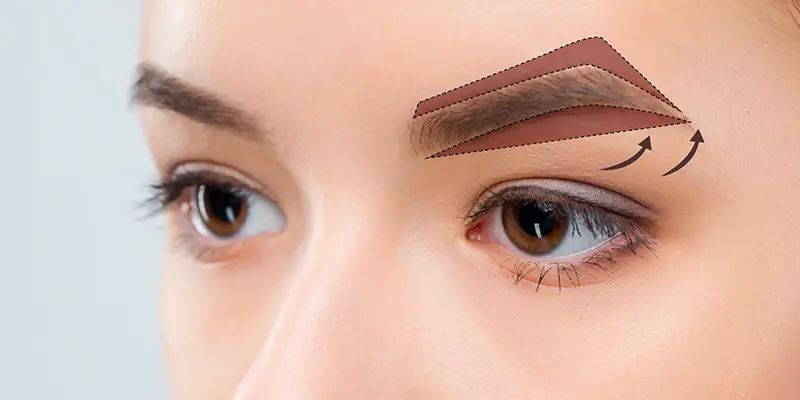 Nâng Cung Chân Mày Là Gì? Treo Cung Chân Mày Ở Đâu Tốt?