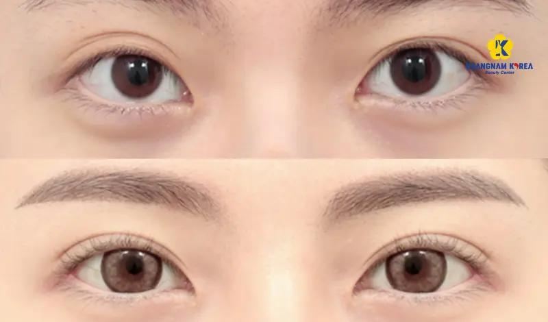 Khách hàng mở góc mắt ngoài