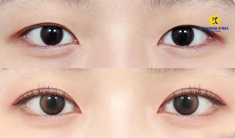 Khách hàng mở góc mắt trong