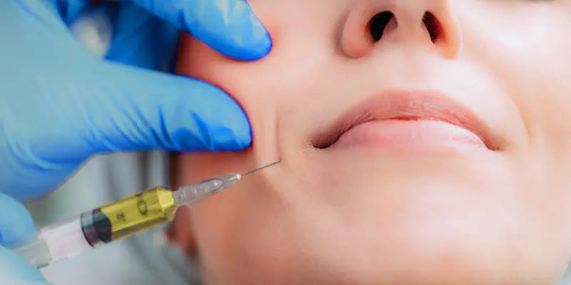 Cấy mỡ tự thân 