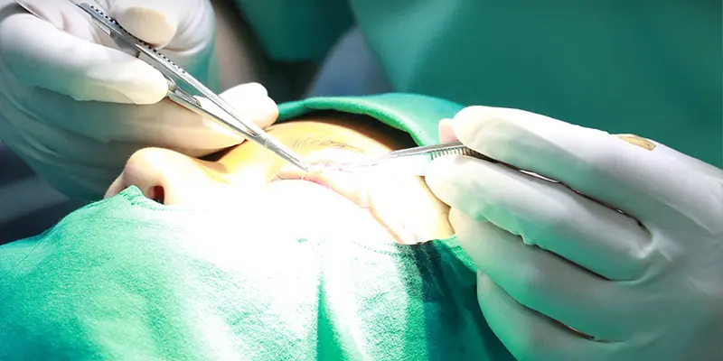 cách chữa sụp mí mắt bằng phẫu thuật