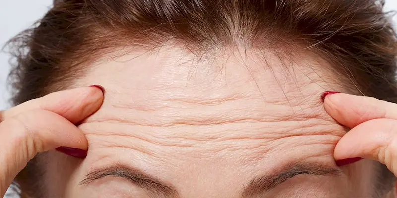 Nếp Nhăn Trán Khiến Khuôn Mặt Trông “Nặng Nề” Già Đi