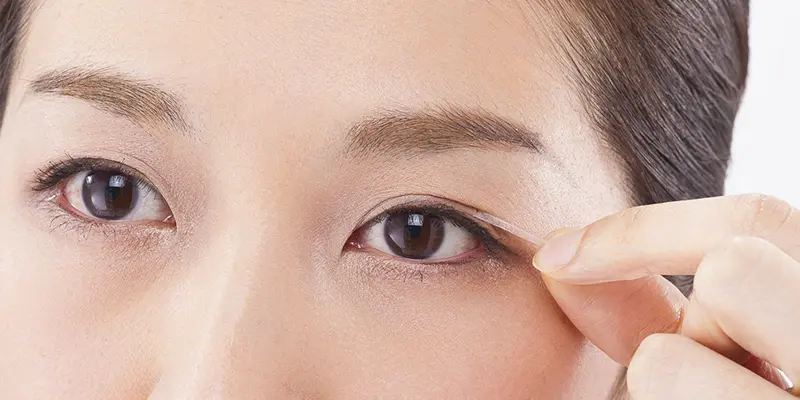 Các phương pháp không phẫu thuật