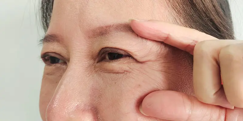 Khi nào cần treo chân mày?