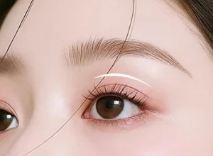 Khi Nào Nên Nâng Cơ Mí Mắt?