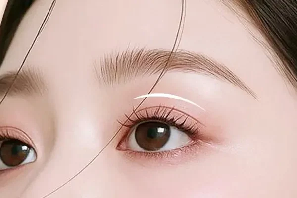 Khi Nào Nên Nâng Cơ Mí Mắt?