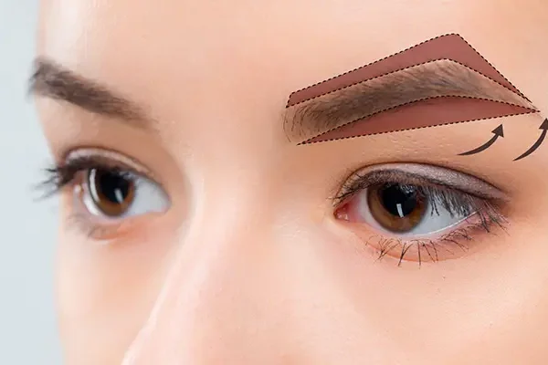 Nâng Cung Chân Mày Là Gì? Treo Cung Chân Mày Ở Đâu Tốt?