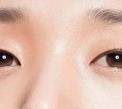 Phẫu thuật chữa sụp mí mắt bẩm sinh ở đâu tốt?