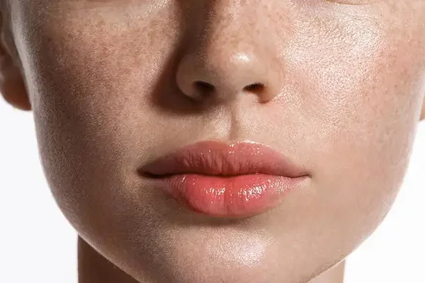 Trị nám da mặt tại Sài Gòn ở đâu tốt